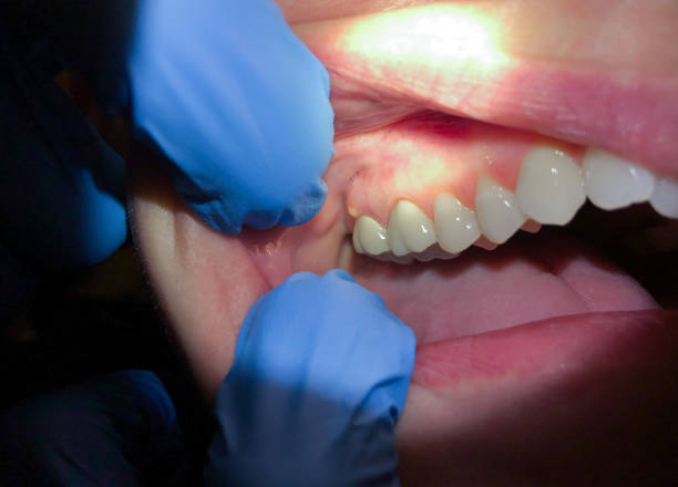 Oradell, NJ Emergency Dentist Pros