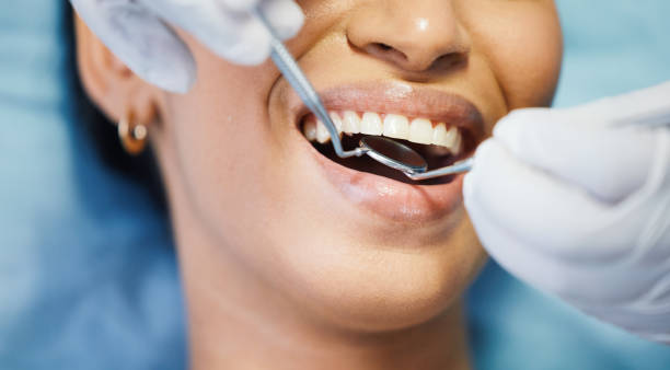 Best Teeth Whitening  in Oradell, NJ