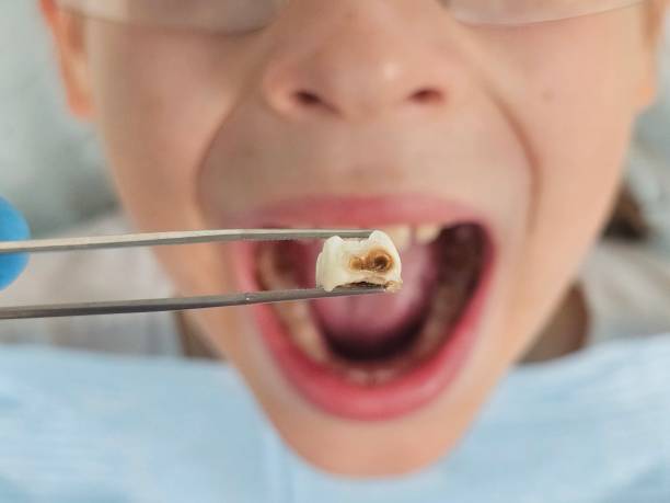 Best Tooth Pain Emergency Relief  in Oradell, NJ